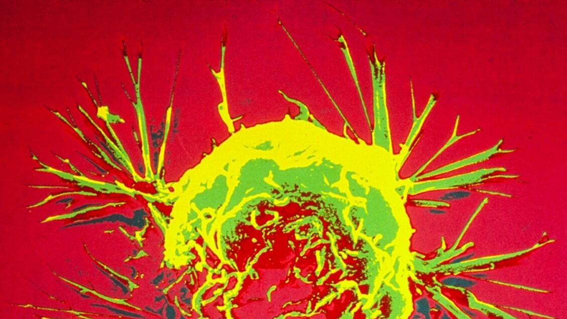 Vaccino anti-cicer jolly, contro molti tipi di cancro - Biotech -