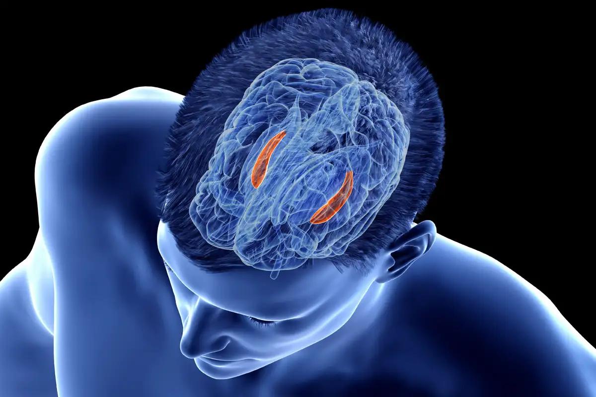 Slowing Alzheimer's Before It Starts: The Breakthrough That Starts With Exercise and Mental Stimulat...