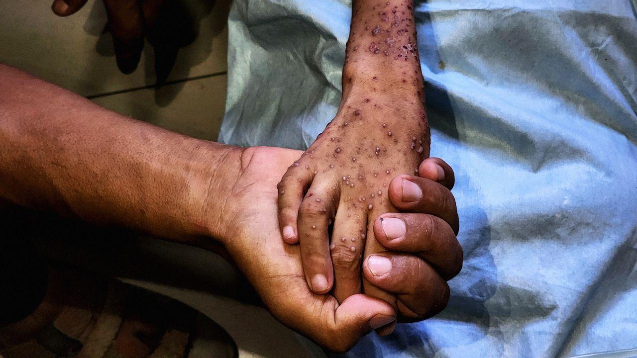 Gas hunger, terrible long -term effects of waist crisis |Italy